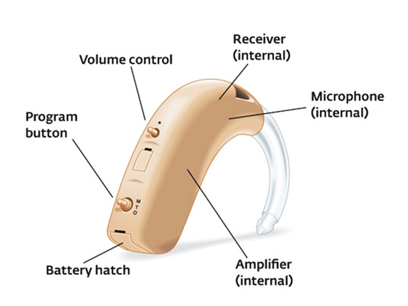 constructure of bte hearing aids.jpg